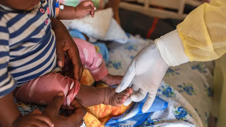 Cross-Border Surveillance Heightens as Mpox Surges In Sierra Leone