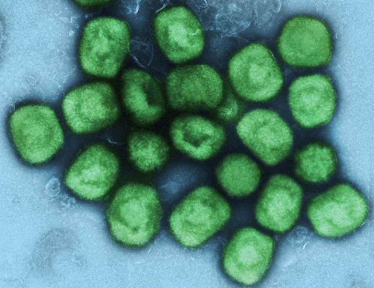 Liberia: Cholera, Measles & Lassa Fever Cases Increasing